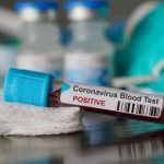 CORONAVIRUS-TUCSON-