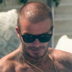 облысел бэкхэм 2